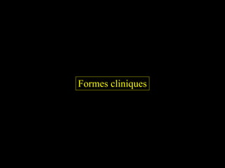 Formes cliniques 