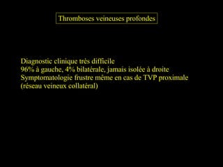 Thromboses veineuses profondes Diagnostic clinique très difficile 96% à gauche, 4% bilatérale, jamais isolée à droite Symptomatologie frustre même en cas de TVP proximale  (réseau veineux collatéral) 