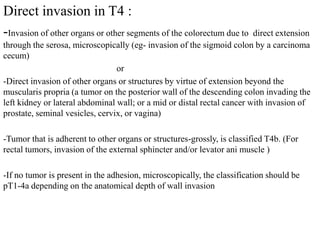 Direct invasion in T4 :
-Invasion of other organs or other segments of the colorectum due to direct extension
through the serosa, microscopically (eg- invasion of the sigmoid colon by a carcinoma
cecum)
or
-Direct invasion of other organs or structures by virtue of extension beyond the
muscularis propria (a tumor on the posterior wall of the descending colon invading the
left kidney or lateral abdominal wall; or a mid or distal rectal cancer with invasion of
prostate, seminal vesicles, cervix, or vagina)
-Tumor that is adherent to other organs or structures-grossly, is classified T4b. (For
rectal tumors, invasion of the external sphincter and/or levator ani muscle )
-If no tumor is present in the adhesion, microscopically, the classification should be
pT1-4a depending on the anatomical depth of wall invasion
 