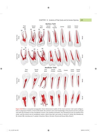 Ch_12_GEP.indd 245 08/08/14 5:03 PM
CHAPTER 12 Anatomy of Pulp Cavity and Its Access Opening
Maxillary Teeth
Third
Molar
MB
DB
Second
Molar
DB DB
MB
First
Molar
MB
Second
Premolar
First
Premolar
B
Canine
Lateral
Incisor
Central
Incisor
P P
P
P
P DB
MB P MB P
MB
P
B
DB
DB
Mandibular Teeth
Third
Molar
Second
Molar
First
Molar
Second
Premolar
First
Premolar
Canine
Lateral
Incisor
Central
Incisor
D
M
ML MB
Figure 12.8 Micro−computed tomographic three−dimensional models of the most common root canal configura-
tions in all groups of teeth. In most of the teeth, the common root canal morphology is the presence of one canal per
root with the exception of the mandibular incisors, the maxillary premolars, the mesiobuccal root of maxillary first
molar, and the mesial root of mandibular molars, which have two root canals. B, buccal; D, distal; DB, distobuccal;
M, mesial; MB, mesiobuccal; P, palatal. (Courtesy: Marco Versiani, Pecora and Sousa-Neto, Brazil.)
245
Lateral
View
Lingual
Frontal
View
Distal
Lateral
View
Palatal
Frontal
View
Distal
Buccal
Mesial
Buccal
Mesial
 