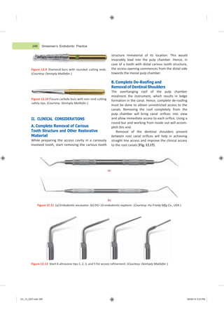 Ch_12_GEP.indd 246 08/08/14 5:03 PM
Grossman’s Endodontic Practice
Figure 12.9 Diamond burs with rounded cutting ends.
(Courtesy: Dentsply Maillefer.)
Figure 12.10 Fissure carbide burs with non−end cutting
safety tips. (Courtesy: Dentsply Maillefer.)
II. CLINICAL CONSIDERATIONS
A. Complete Removal of Carious
Tooth Structure and Other Restorative
Material
While preparing the access cavity in a cariously
involved tooth, start removing the carious tooth
structure immaterial of its location. This would
invariably lead into the pulp chamber. Hence, in
case of a tooth with distal carious tooth structure,
the access opening commences from the distal side
towards the mesial pulp chamber.
B. Complete De-Roofing and
Removal of Dentinal Shoulders
The overhanging roof of the pulp chamber
misdirects the instrument, which results in ledge
formation in the canal. Hence, complete de-roofing
must be done to obtain unrestricted access to the
canals. Removing the roof completely from the
pulp chamber will bring canal orifices into view
and allow immediate access to each orifice. Using a
round bur and working from inside out will accom-
plish this end.
Removal of the dentinal shoulders present
between root canal orifices will help in achieving
straight line access and improve the clinical access
to the root canals (Fig. 12.15).
(a)
(b)
Figure 12.11 (a) Endodontic excavator. (b) DG−16 endodontic explorer. (Courtesy: Hu-Friedy Mfg Co., USA.)
Figure 12.12 Start X ultrasonic tips 1, 2, 3, and 5 for access refinement. (Courtesy: Dentsply Maillefer.)
246
 
