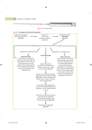 350 Grossman’s Endodontic Practice
Ch_15_GEP.indd 350 08/08/14 5:09 PM
Short of the apex
If the initial fit is short of the
working length, then patency
has to be established to the
corrected length followed
by sequential irrigation,
recapitulation, and shaping of
the canal to the master apical
file size. Another primary gutta−
percha cone is fitted to the
corrected working length for
radiographic verification.
Master cone inserted till working
length and a hand or finger spreader
(Fig. 15.8) is inserted alongside the
master cone to a level 1 mm short
of the working length
Sealer manipulation
and coat the canal with sealer
using the master cone or with
a lentulo spiral (Fig. 15.7)
At working length
Inadequate fit − Short of the apex
Checking for apical
“TUG BACK”
(Fig. 15.5)
Selection of
master cone
(same size as Master
Apical File)
Isolation and drying the
canal with paper points
(Fig. 15.6)
Beyond the apex
If the master cone extends
beyond the working length, the
tip should be cut off so that the
reinserted primary cone fits
snugly at the working length or
the next larger size gutta−percha
cone is inserted and verified
radiographically.
Inadequate fit − Beyond the apex
Radiographic verification of master cone fit
Figure 15.7 Lentulo spiral.
Box 15.5 Technique of Cold Lateral Compaction
Postobturation radiograph
(Fig. 15.9)
Placement of sequential accessory
cones by lateral compaction
until complete obturation of the
radicular pulp space (Fig. 15.5)
The spreader is disengaged from
the cone by rotating it between the
fingertips or by rotating the handle
in an arc
 