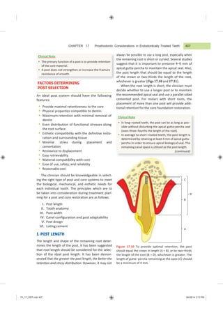 CHAPTER 17 Prosthodontic Considerations in Endodontically Treated Teeth 407
Ch_17_GEP.indd 407 08/08/14 3:12 PM
C
D
B
A
Clinical Note
 In long−rooted teeth, the post can be as long as pos−
sible without disturbing the apical gutta−percha seal
(even three−fourths the length of the root).
 In average to short−rooted teeth, the post length is
determined by retaining at least 4 mm of apical gutta−
percha in order to ensure apical biological seal. The
remaining canal space is utilized as the post length.
(continued)
FACTORS DETERMINING
POST SELECTION
An ideal post system should have the following
features:
 Provide maximal retentiveness to the core
 Physical properties compatible to dentin
 Maximum retention with minimal removal of
dentin
 Even distribution of functional stresses along
the root surface
 Esthetic compatibility with the definitive resto-
ration and surrounding tissue
 Minimal stress during placement and
cementation
 Resistance to displacement
 Easy retrievability
 Material compatibility with core
 Ease of use, safety, and reliability
 Reasonable cost
The clinician should be knowledgeable in select-
ing the right type of post and core systems to meet
the biological, mechanical, and esthetic needs for
each individual tooth. The principles which are to
be taken into consideration during treatment plan-
ning for a post and core restoration are as follows:
I. Post length
II. Tooth anatomy
III. Post width
IV. Canal configuration and post adaptability
V. Post design
VI. Luting cement
I. POST LENGTH
The length and shape of the remaining root deter-
mines the length of the post. It has been suggested
that root length should be considered for the selec-
tion of the ideal post length. It has been demon-
strated that the greater the post length, the better the
retention and stress distribution. However, it may not
always be possible to use a long post, especially when
the remaining root is short or curved. Several studies
suggest that it is important to preserve 4–6 mm of
apical gutta-percha to maintain the apical seal. Also,
the post length that should be equal to the length
of the crown or two-thirds the length of the root,
whichever is greater (Figs 17.10 and 17.11).
When the root length is short, the clinician must
decide whether to use a longer post or to maintain
the recommended apical seal and use a parallel-sided
cemented post. For molars with short roots, the
placement of more than one post will provide addi-
tional retention for the core foundation restoration.
Figure 17.10 To provide optimal retention, the post
should equal the crown in length (A = B), or be two−thirds
the length of the root (B = D), whichever is greater. The
length of gutta−percha remaining at the apex (C) should
be a minimum of 4 mm.
Clinical Note
 The primary function of a post is to provide retention
of the core material.
 A post does not strengthen or increase the fracture
resistance of a tooth.
 