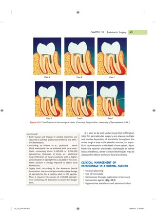 CHAPTER 20 Endodontic Surgery 471
Ch_20_GEP.indd 471 08/08/14 11:40 AM
Class A Class B Class C
Class D Class E Class F
Figure 20.8 Classification of microsurgical cases. (Courtesy: Syngcuk Kim, University of Pennsylvania, USA.)
It is also to be well understood that infiltration
sites for periradicular surgery are always multiple
and involve deposition of anesthetic throughout the
entire surgical area in the alveolar mucosa just super-
ficial to periosteum at the level of root apices. Apart
from the routine anesthetic techniques of nerve
block anesthesia, other standard techniques may be
observed to obtain profound local anesthesia.
CLINICAL MANAGEMENT OF
HEMORRHAGE IN A NORMAL PATIENT
 Incision planning
 Use of hemostats
 Hemostasis through application of pressure
 Hemostatic agents (Fig. 20.9)
 Hypotensive anesthesia and vasoconstrictors
(continued)
 Both buccal and lingual or palatal injections are
required to achieve profound anesthesia and effec-
tive hemostasis.
 According to Miliam et al., profound nerve
block anesthesia can be achieved with local anes-
thetic containing dilute 1:100,000 or 1:200,000
epinephrine. However, at times, an additional
local infiltration of local anesthetic with a higher
concentration of epinephrine (1:50,000) in the anes-
thetic solution is always required to obtain local
hemostasis.
 Safety limit: According to the American Dental
Association, the maximal permissible safety dosage
of epinephrine for a healthy adult is 200 µg/day.
Thus, it requires 10 carpules of 1:50,000 epineph-
rine containing 2% lidocaine to reach the danger
limit.
 