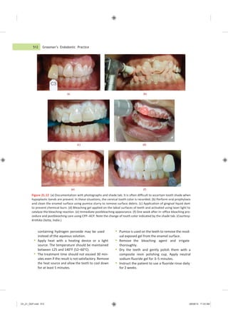 512 Grossman’s Endodontic Practice
Ch_21_GEP.indd 512 08/08/14 11:43 AM
(a) (b)
(c) (d)
(e) (f)
Figure 21.12 (a) Documentation with photographs and shade tab. It is often difficult to ascertain tooth shade when
hypoplastic bands are present. In these situations, the cervical tooth color is recorded. (b) Perform oral prophylaxis
and clean the enamel surface using pumice slurry to remove surface debris. (c) Application of gingival liquid dam
to prevent chemical burn. (d) Bleaching gel applied on the labial surfaces of teeth and activated using laser light to
catalyze the bleaching reaction. (e) Immediate postbleaching appearance. (f) One week after in−office bleaching pro-
cedure and postbleaching care using CPP−ACP. Note the change of tooth color indicated by the shade tab. (Courtesy:
Krithika Datta, India.)
containing hydrogen peroxide may be used
instead of the aqueous solution.
 Apply heat with a heating device or a light
source. The temperature should be maintained
between 125 and 140°F (52–60°C).
 The treatment time should not exceed 30 min-
utes even if the result is not satisfactory. Remove
the heat source and allow the teeth to cool down
for at least 5 minutes.
 Pumice is used on the teeth to remove the resid-
ual exposed gel from the enamel surface.
 Remove the bleaching agent and irrigate
thoroughly.
 Dry the teeth and gently polish them with a
composite resin polishing cup. Apply neutral
sodium fluoride gel for 3–5 minutes.
 Instruct the patient to use a fluoride rinse daily
for 2 weeks.
 