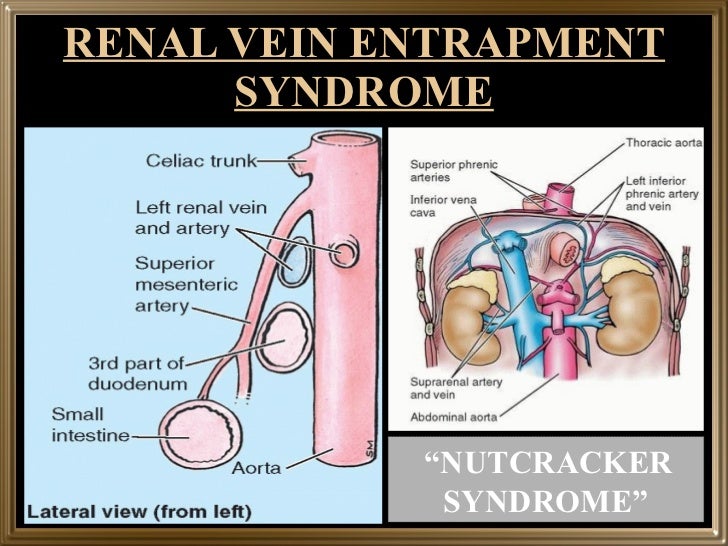 Gross structure of kidney and ureter