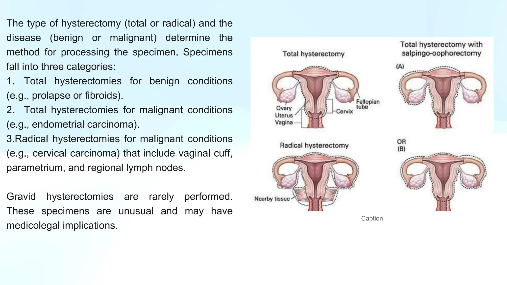 GROSS UTERUS with cervix and fallopian tube PPT.pptx