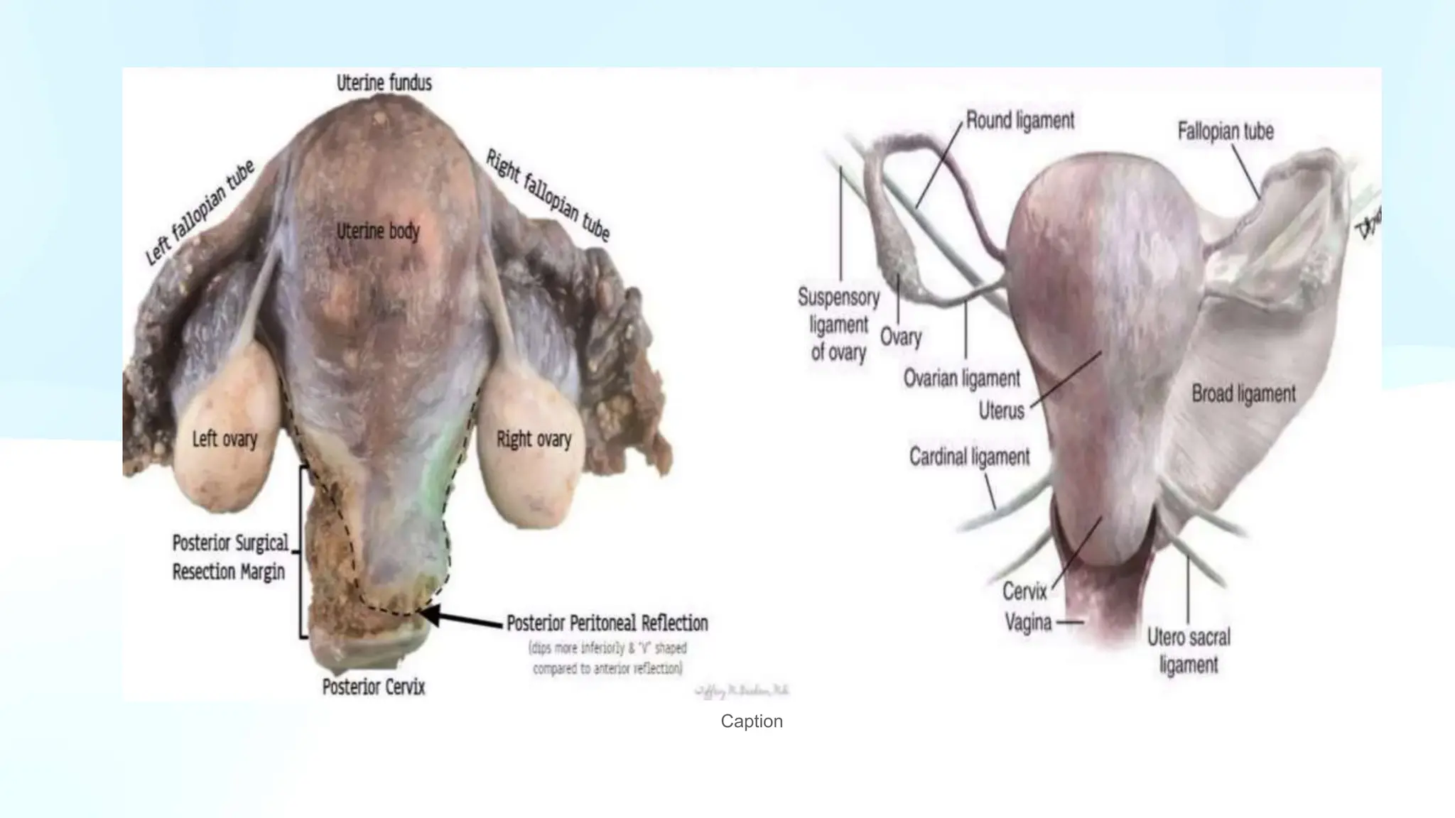 GROSS UTERUS with cervix and fallopian tube PPT.pptx