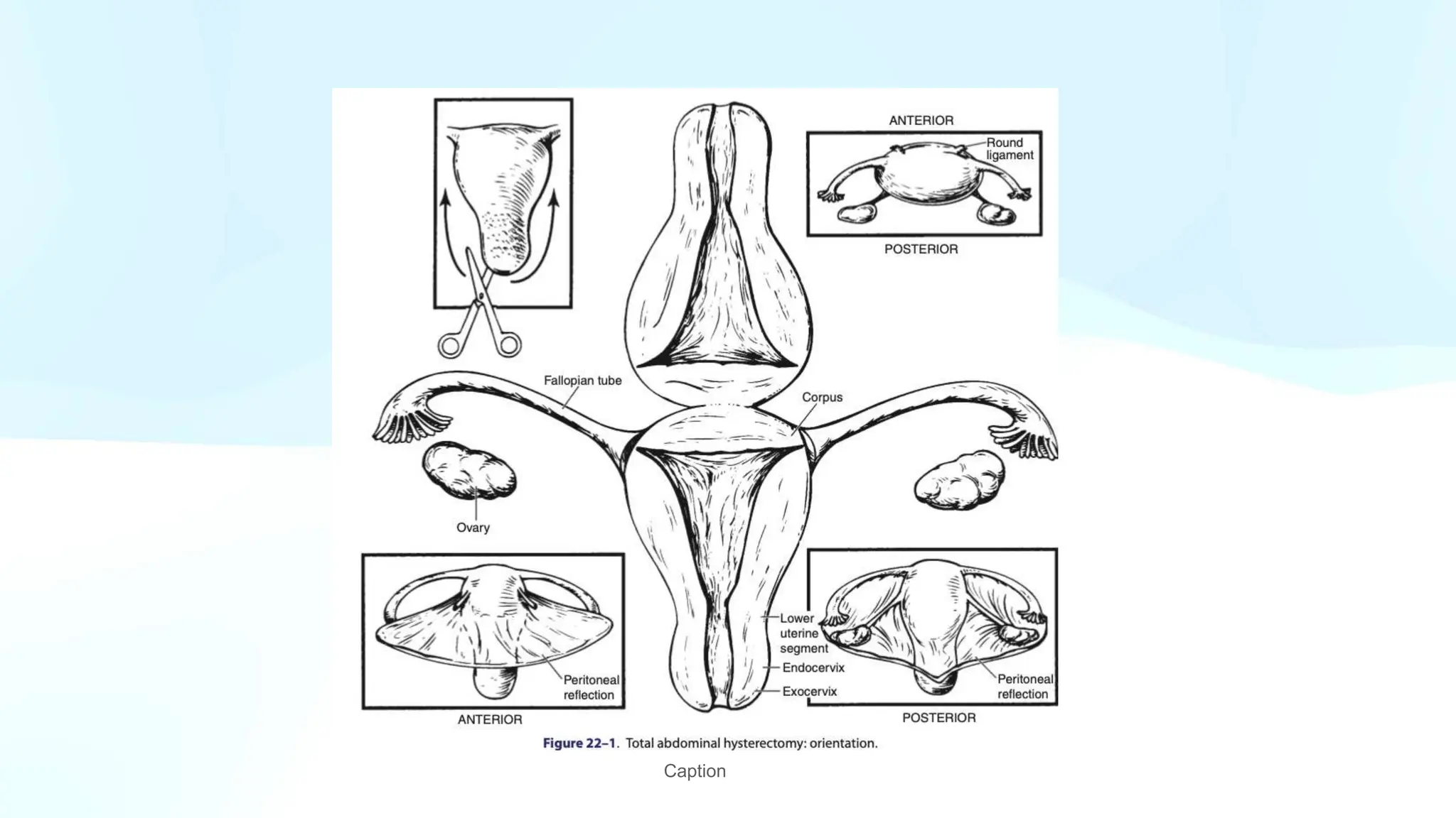 GROSS UTERUS with cervix and fallopian tube PPT.pptx