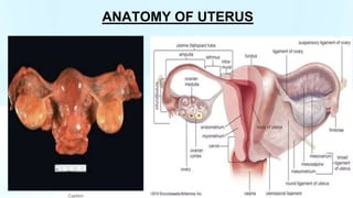 GROSS UTERUS with cervix and fallopian tube PPT.pptx
