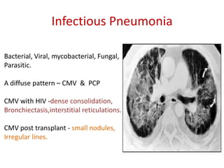 Infectious Pneumonia
Bacterial, Viral, mycobacterial, Fungal,
Parasitic.
A diffuse pattern – CMV & PCP
CMV with HIV -dense consolidation,
Bronchiectasis,interstitial reticulations.
CMV post transplant - small nodules,
Irregular lines.
 