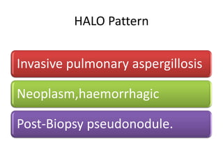 HALO Pattern
Invasive pulmonary aspergillosis
Neoplasm,haemorrhagic
Post-Biopsy pseudonodule.
 