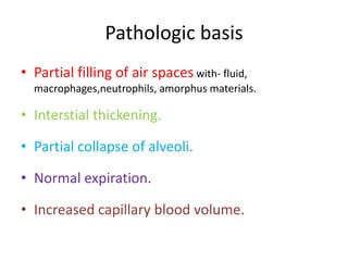 Pathologic basis
• Partial filling of air spaces with- fluid,
macrophages,neutrophils, amorphus materials.
• Interstial thickening.
• Partial collapse of alveoli.
• Normal expiration.
• Increased capillary blood volume.
 