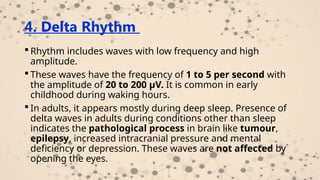 Delta Rhythm Script Physiology of sleep electrical activities of the brain, sleep -wake ...
