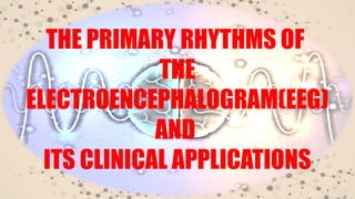Physiology of sleep electrical activities of the brain, sleep -wake ...