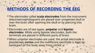 Physiology of sleep electrical activities of the brain, sleep -wake ...
