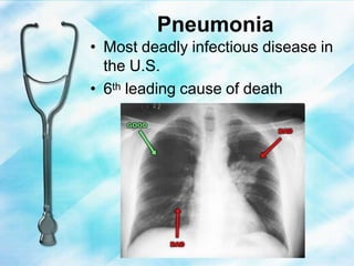 Pneumonia
• Most deadly infectious disease in
the U.S.
• 6th leading cause of death
 
