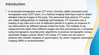 Introduction.
• A computed tomography scan (CT scan), formerly called computed axial
tomography scan (CAT scan), is a medical imaging technique used to obtain
detailed internal images of the body. The personnel that perform CT scans
are called radiographers or radiology technologists. CT scanners use a
rotating X-ray tube and a row of detectors placed in a gantry to measure X-
ray attenuations by different tissues inside the body. The multiple X-ray
measurements taken from different angles are then processed on a computer
using tomographic reconstruction algorithms to produce tomographic (cross-
sectional) images (virtual "slices") of a body. CT scans can be used in
patients with metallic implants or pacemakers, for whom magnetic resonance
imaging (MRI) is contraindicated.
 