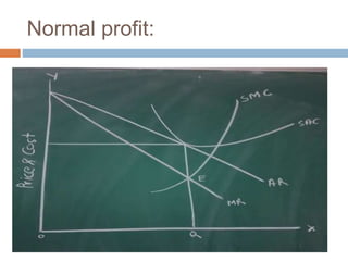 Normal profit:
D = Market Demand
ATC = Average Total
Cost
MR = Marginal Revenue
MC = Marginal Cost
 