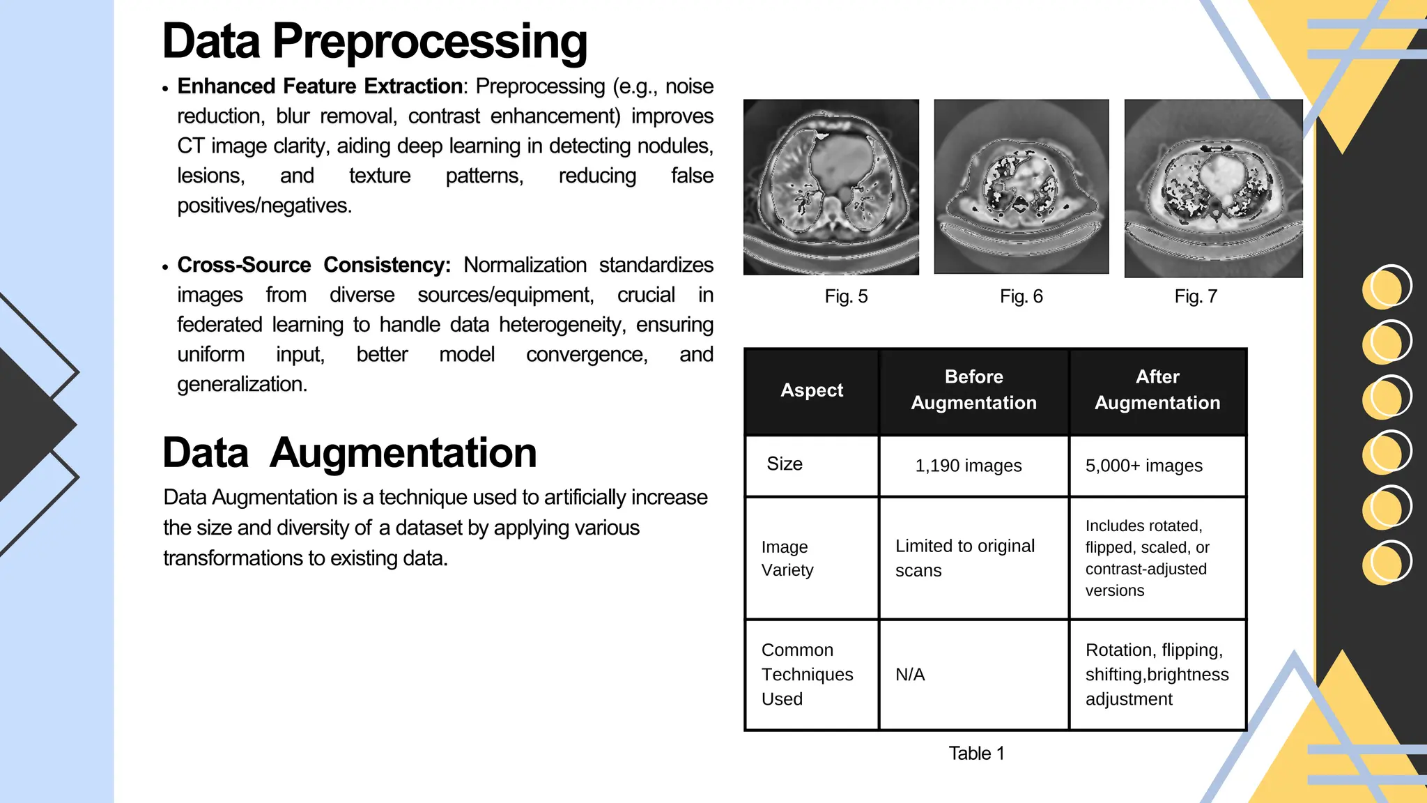 Aspect
Before
Augmentation
After
Augmentation
Size 1,190 images 5,000+ images
Image
Variety
Limited to original
scans
Includes rotated,
flipped, scaled, or
contrast-adjusted
versions
Common
Techniques
Used
N/A
Rotation, flipping,
shifting,brightness
adjustment
Data Preprocessing
Fig. 7
Fig. 5 Fig. 6
Data Augmentation
Data Augmentation is a technique used to artificially increase
the size and diversity of a dataset by applying various
transformations to existing data.
Table 1
 