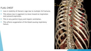 anatomy presentation slide from the thoracic cage .pptx