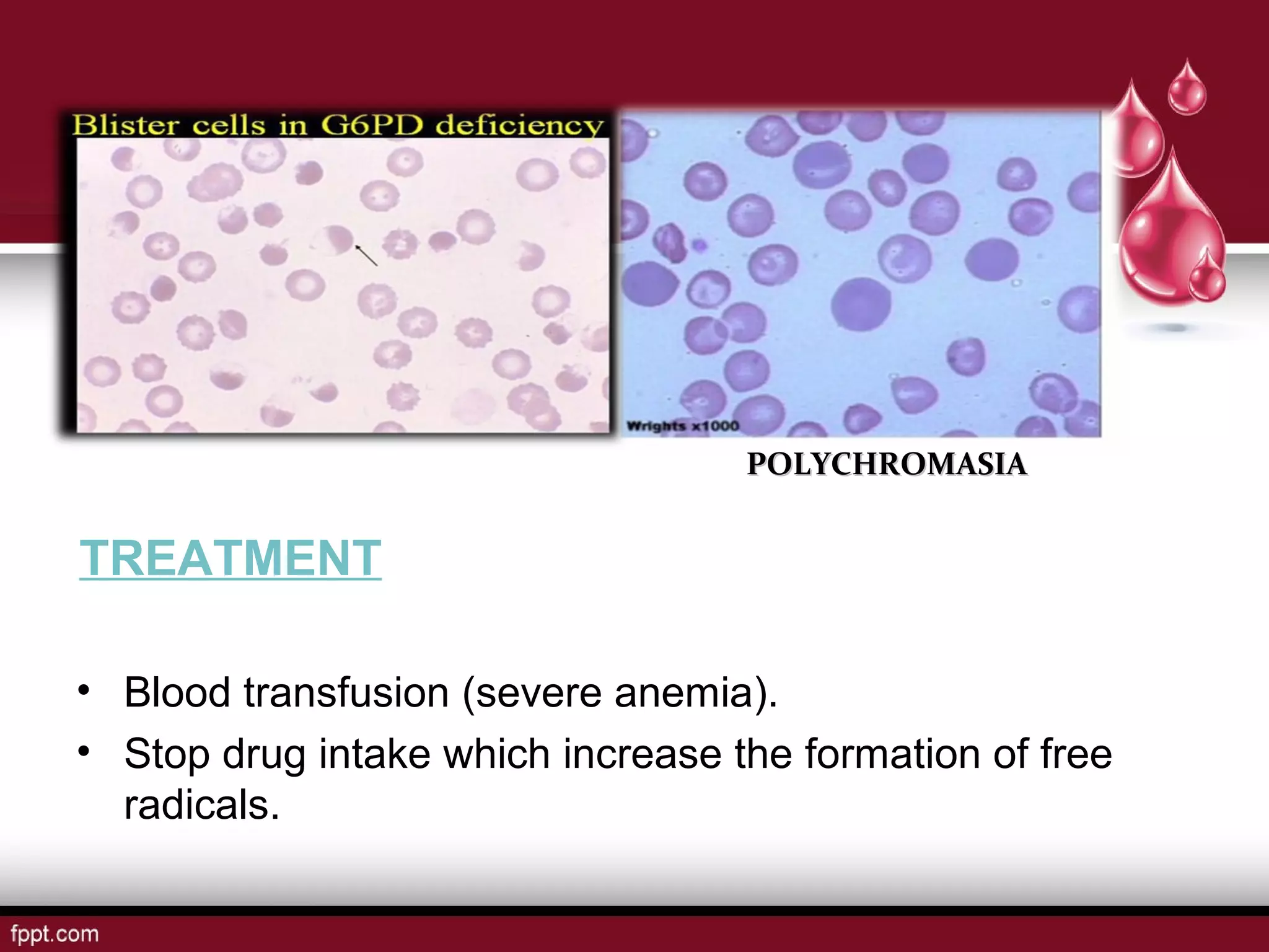 Choose All That May Cause Hemolytic Anemia. hemolytic anemias | PPT