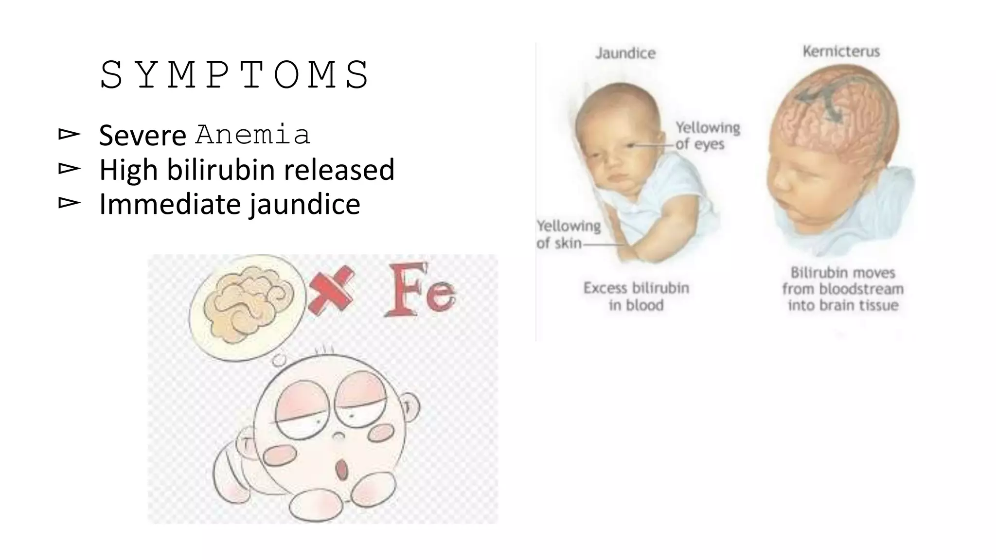 ▻ Severe Anemia
▻ High bilirubin released
▻ Immediate jaundice
S Y M P T O M S
 