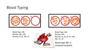 Type B Sample ABO Blood Type Incompatibility | PPTX