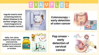 A S
X P
M L E
E
regular exams and
screening tests to
detect disease in its
earliest stages (e.g.
mammograms to
detect breast cancer)
Pap smear -
early
detection of
cervical
cancer
Colonoscopy -
early detection
of colon cancer
daily, low-dose
aspirins and/or diet
and exercise
programs to prevent
further heart attacks
or strokes
 