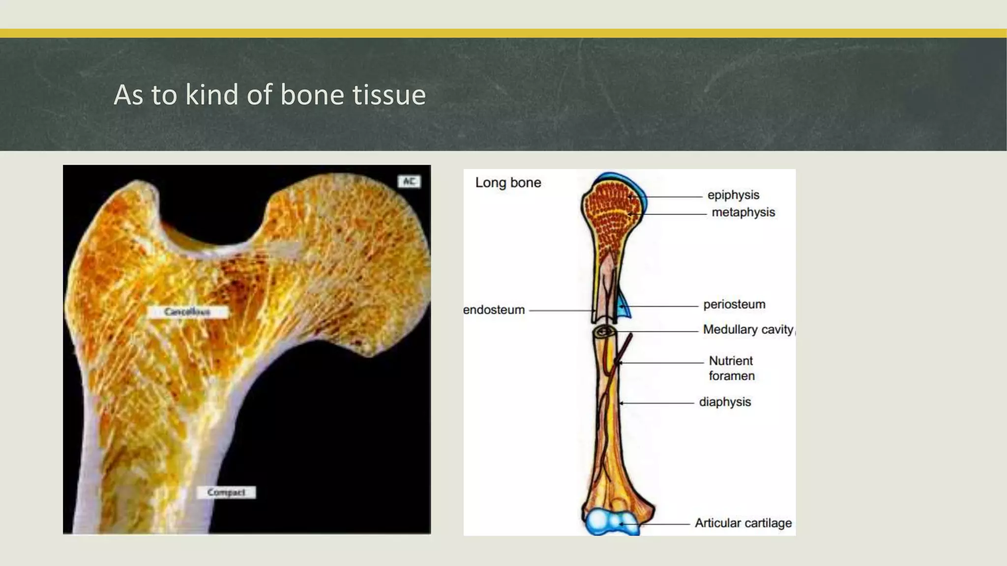 As to kind of bone tissue
 