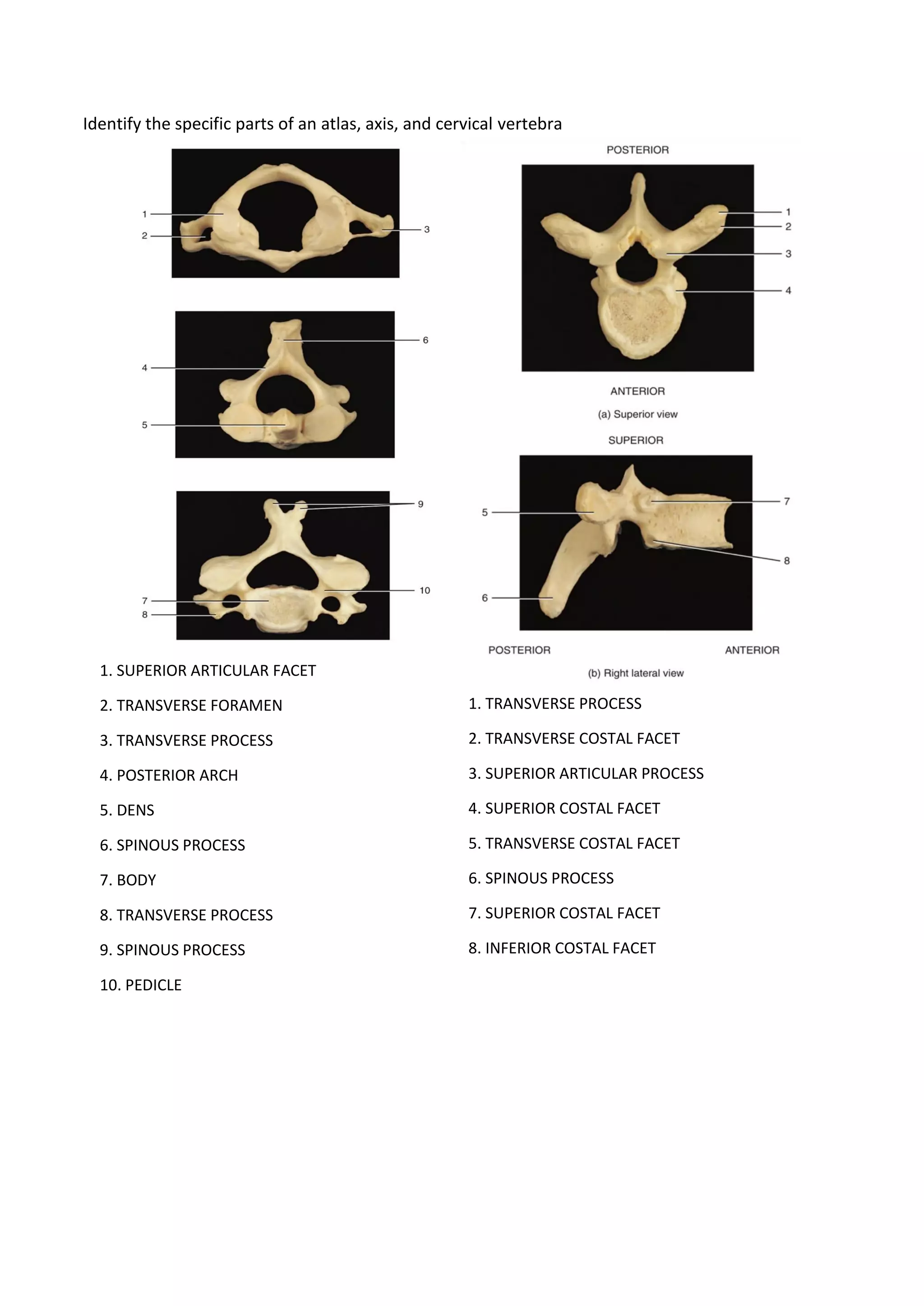 Identify the specific parts of an atlas, axis, and cervical vertebra
1. TRANSVERSE PROCESS
2. TRANSVERSE COSTAL FACET
3. SUPERIOR ARTICULAR PROCESS
4. SUPERIOR COSTAL FACET
5. TRANSVERSE COSTAL FACET
6. SPINOUS PROCESS
7. SUPERIOR COSTAL FACET
8. INFERIOR COSTAL FACET
1. SUPERIOR ARTICULAR FACET
2. TRANSVERSE FORAMEN
3. TRANSVERSE PROCESS
4. POSTERIOR ARCH
5. DENS
6. SPINOUS PROCESS
7. BODY
8. TRANSVERSE PROCESS
9. SPINOUS PROCESS
10. PEDICLE
 