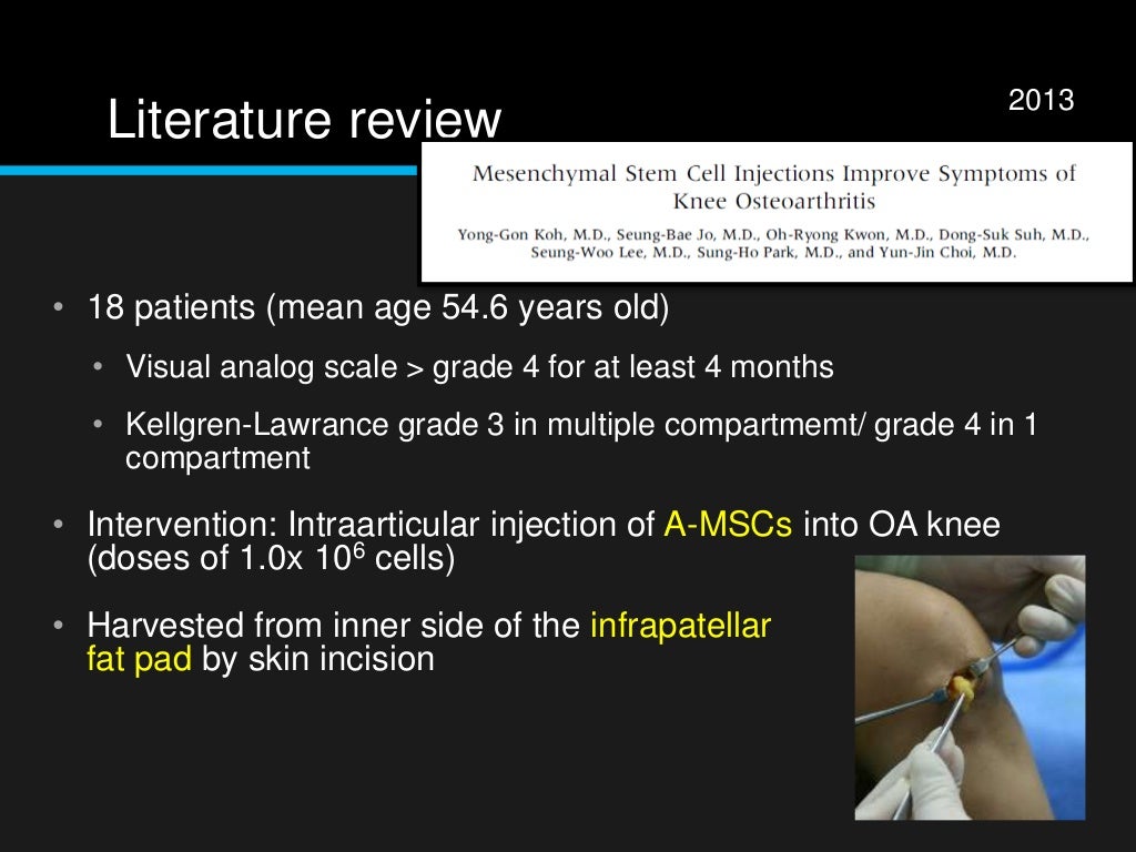 stem cell treatment for knee stem cell treatment for knee