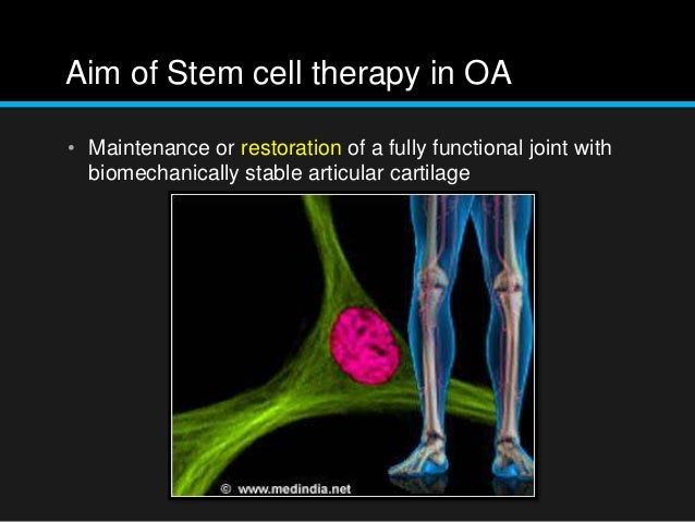 Stem cell treatment for OA knee Hype or Promise?