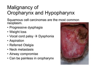 Malignancy of
Oropharynx and Hypopharynx
Squamous cell carcinomas are the most common
neoplasm.
• Progressive dysphagia
• Weight loss
• Vocal cord palsy  Dysphonia
• Aspiration
• Referred Otalgia
• Neck metastasis
• Airway compromise
• Can be painless in oropharynx
 