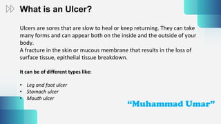 Peptic ulcers and treatment | PPTX