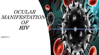 OCULAR
MANIFESTATION
OF
HIV
GROUP 4
 