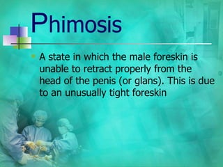 P himosis ,[object Object]