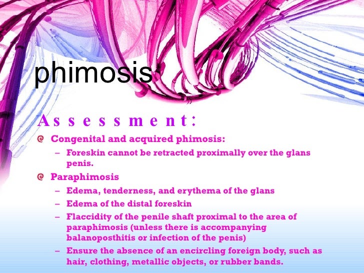 Phimose hydrocortison Hilft die Phimose hydrocortison What are
