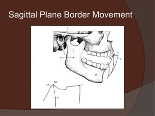 Single Plane Border MovementSagittal plane border and functional movementHorizontal plane border and functional movementFrontal (vertical) border and functional movement