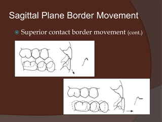 Sagittal Plane Border MovementSuperior contact border movement