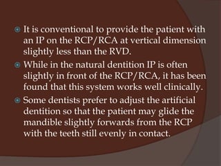 Method of recording OVDMechanicalRidge relation