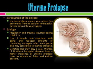 Introduction of the disease  Uterine prolapse means your uterus has descended from its position in the pelvis farther down into your vagina.  Etiology  Pregnancy and trauma incurred during childbirth.  Loss of muscle tone associated with aging and reduced amounts of circulating estrogen after menopause also may contribute to uterine prolapse.  Genetics also may play a role. Women of Northern European descent have a higher incidence of uterine prolapse than do women of Asian and African descent.  