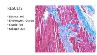 RESULTS
• Nucleus red
• Erythrocytes Orange
• Muscle Red
• Collagen Blue
 