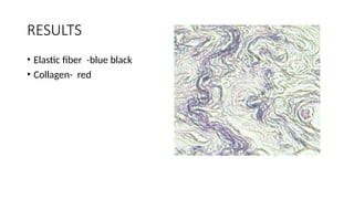 RESULTS
• Elastic fiber -blue black
• Collagen- red
 