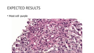EXPECTED RESULTS
• Mast cell -purple
 