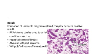 .
Result
Formation of insoluble magenta colored complex denotes positive
result.
• PAS staining can be used to assist in the diagnosis of several medical
conditions such as:
• Paget’s disease of breast
• Alveolar soft part sarcoma
• Whipple’s disease of immature RBCs
 