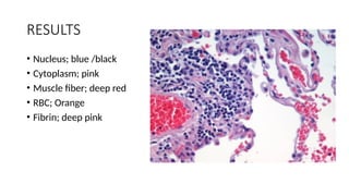 RESULTS
• Nucleus; blue /black
• Cytoplasm; pink
• Muscle fiber; deep red
• RBC; Orange
• Fibrin; deep pink
 