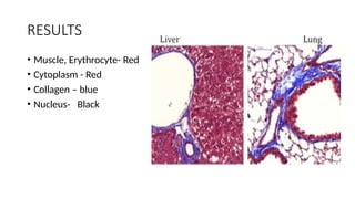 RESULTS
• Muscle, Erythrocyte- Red
• Cytoplasm - Red
• Collagen – blue
• Nucleus- Black
 