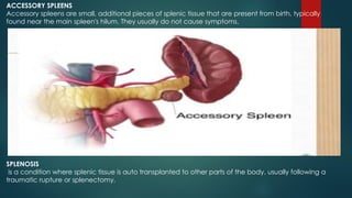 Anatomy of the spleen MAN210 PRESENTATION.pptx