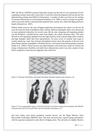 19 | P a g e
2003, the Devax AXXESS coronary bifurcation system was the first of a new generation of self-
expanding coronary stents after a more than 15-year lull in their development and was also the first
dedicated drug eluting stent (DES) for bifurcations. A number of other novel devices for stenting
of coronary bifurcations are in development (Jilaihawi et al., 2009) as well as a unique low profile,
small vessel stent which is electrolytically detached from a guide wire, rather that deployed from a
sheath (Abizaid et al., 2007).
Without doubt, however, the area of biggest application development for nitinol over the last 20
years has been the field of peripheral artery stenting. Balloon-expandable stents were being used
in many peripheral indications for several years, but the only competing self-expanding product
was the Wallstent, a braided device made from Elgiloy, the cobalt–chromium alloy. This stent
derived its self-expanding capability from the high elasticity of the material (high elastic modulus
and high strength), rather than from superelasticity. An early review of vascular stent usage in
carotid, subclavian, renal, iliac, femoral and popliteal arteries shows the majority of devices to be
either Palmaz balloon expandable or Wallstent devices, with nitinol stents barely getting a mention
(Duda et al., 2002a). Nitinol however provided designers with much more scope for control and
tuning of deployment, flexibility and radial force characteristics and it was only a matter of time
before competitive nitinol devices appeared. One of the first
Figure 12: Drawing of the Radius stent design illustrating individual segments and connectors. [2]
Figure 13: X-ray angiographic images of internal carotid artery (a) before stenting, (b) immediately after SMART
stent placement and (c) at 6-month follow-up showing high vessel patency. [2]
and most widely used nitinol peripheral vascular devices was the Shape Memory Alloy
Recoverable Technology (SMART) stent. This laser cut device has a typical zigzag strut pattern,
with the segments connected to each other by bridging struts. The end struts are slightly flared to
 